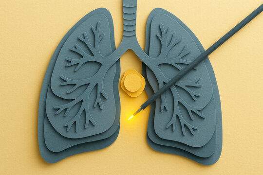 Paper cut lung illustration with needle aspiration catheter inserted through airway wall showing glowing yellow tip sampling lymph node