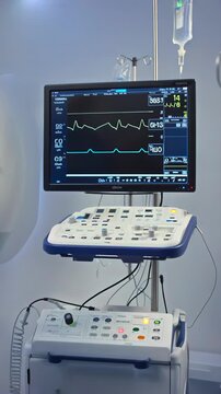 Clinical team inspecting cardiac waveform during diagnostic imaging procedure. Medical staff carefully observing ECG output on monitor amidst medical equipment and staff during procedure