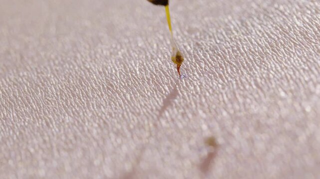 Honey Bee Stinging Human Skin with Visible Stinger Close Up Macro