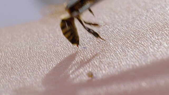 Honey Bee Stinging Human Skin with Visible Stinger Close Up Macro