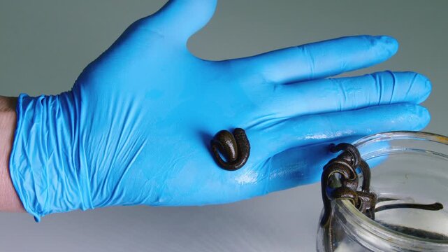Medical Leech on Gloved Hand During Hirudotherapy Preparation Close Up