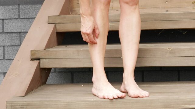 Woman scratches her leg after a mosquito bite, feels swelling and allergies. Dry skin irritation, eczema or insect bites concept