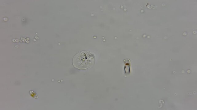 Real footage of live amoeba moving under light microscope 