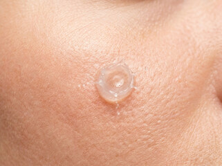 Fototapeta premium Serum droplet landing on cheek, showcasing skincare application and hydration
