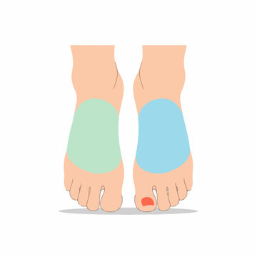 Human feet with colored pain or pressure zones. Flat design vector illustration of podiatry and foot care. Orthotics and medical concept isolated on white background