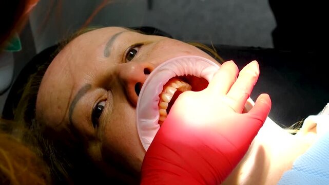 Dental implant crown placement using cheek retractor implant screwdriver and saliva ejector followed by patient smiling at beautiful treatment result in mirror