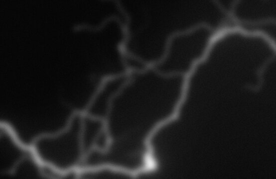 Angiographic imaging of cerebral arterial blood vessels with contrast highlighting