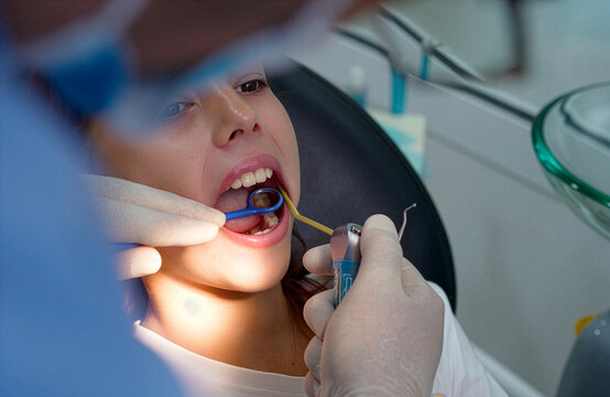 Close up over the shoulder shot of a dentist using a dental handpiece drill and mirror to treat caries or polish teeth of a brave young girl patient sitting in a dental chair.