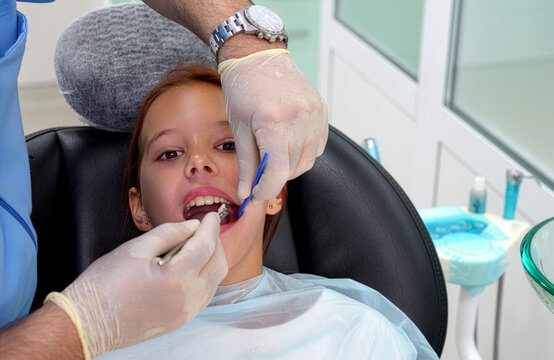 Dentist placing cotton roll in little girl mouth with tweezers during treatment close up.