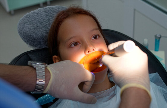 Close up high angle shot of a dentist using a dental UV curing light tool with an orange eye protection shield to harden a filling composite in a young girl patient's open mouth