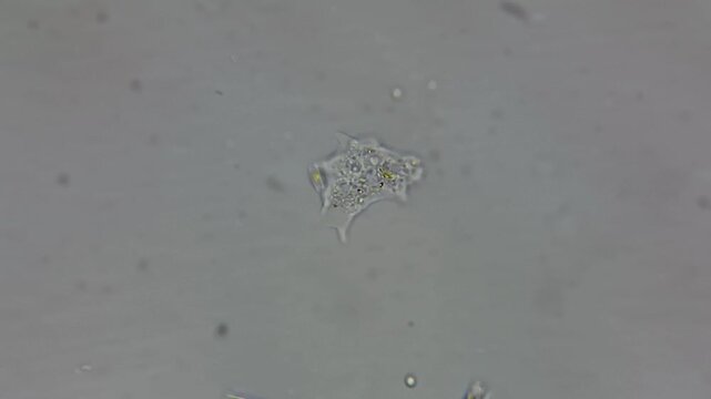 ​Real footage of live amoeba moving under light microscope 