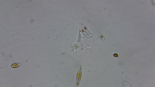 ​Real footage of live amoeba moving under light microscope 