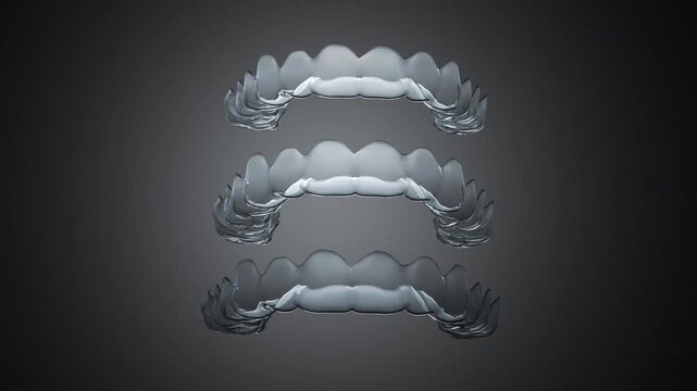 Orthodontic clear aligner conceptual footage.