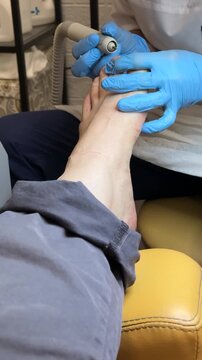 Close-up foot pedicure salon, master uses diamond drill on male foot wearing blue gloves, callus removal around heel and toes