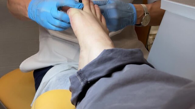Close-up hardware pedicure female technician working on male foot, blue gloves gently grinding nails with electric drill, callus