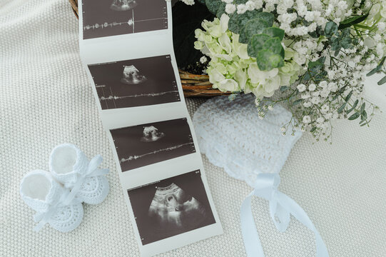 wedding bouquet on the table with sonogram 