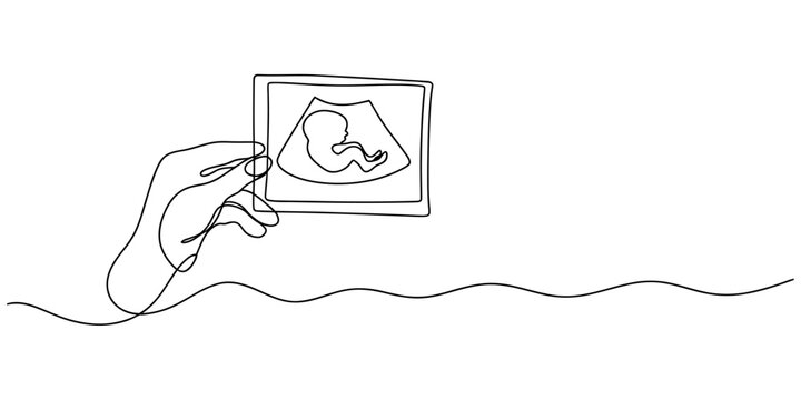 Continuous line drawing of a hand holding an ultrasound scan image of a small baby