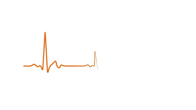 Animated Damped Waveform Signal Fade Out Oscillation Line on White Background Set