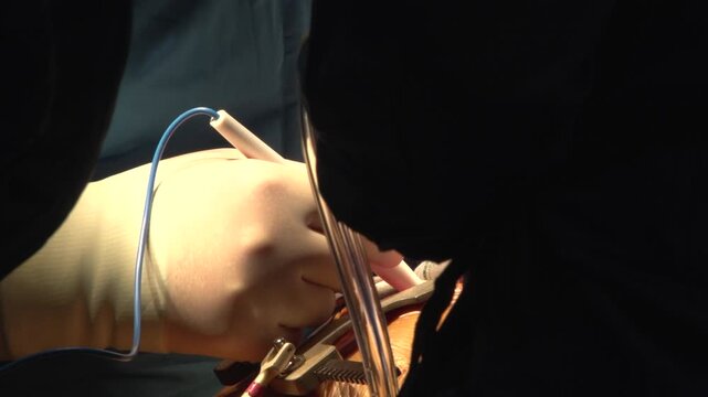 Extreme close-up shot of a surgeon in sterile gloves using an electrosurgical cautery pen and medical forceps at an incision site held by retractors during an operation in an operating room.