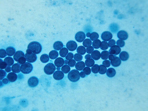 Original image of *Trichophyton mentagrophytes* stained with lactophenol cotton blue, showing characteristic clusters of spherical microconidia; a dermatophyte pathogen.