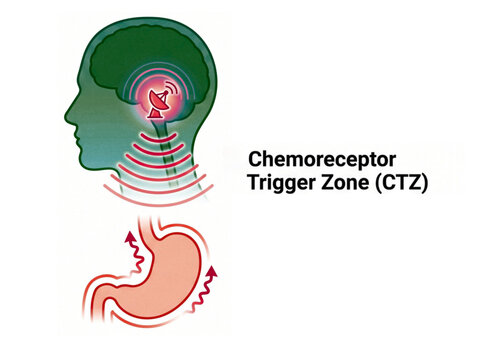Chemoreceptor trigger zone diagram shows the physiological pathway between the human brain and stomach that initiates the reflexive vomiting response in a clinical and educational setting.