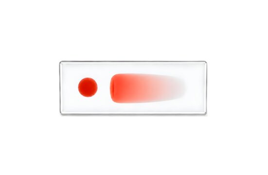 Blood Smear Thick and Thin on Microscope Glass Slide Isolated on White Background