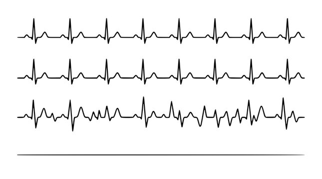 Vector graphic illustration of heart rate ecg rhythm strips design