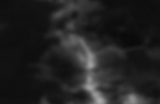 Faint x-ray image of vertebral column and spine structure