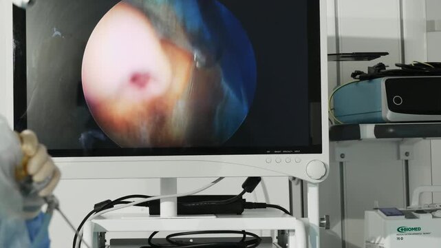 Advanced healthcare equipment displaying live internal surgery operation. Surgeon controls nasal endoscopy process in hospital room