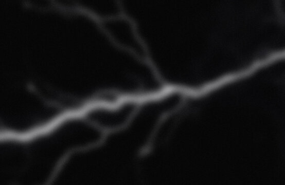 Angiographic imaging of cerebral blood vessels