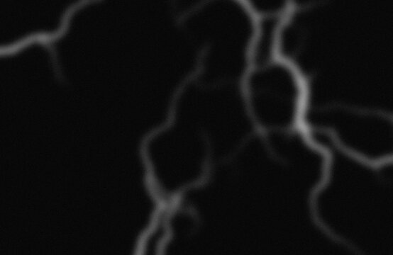 Angiographic imaging of cerebral blood vessels and aneurysm