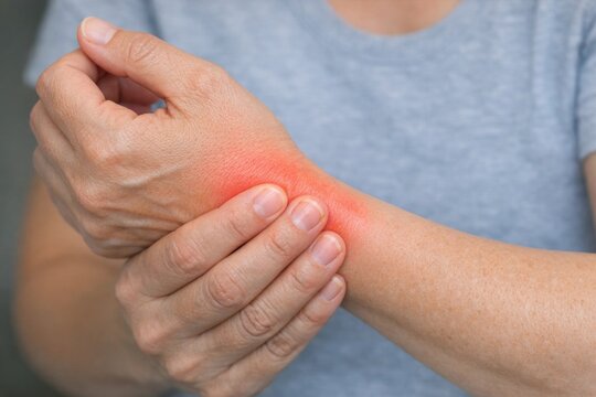 A person with a red spot on their arm, possibly an allergic reaction or bug bite