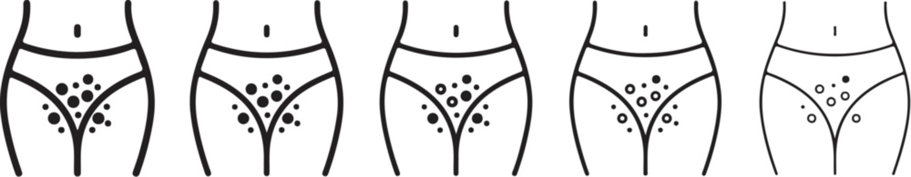 Female pubic hair removal stages vector illustration series on white background pubic hair removal bikini line waxing hair removal