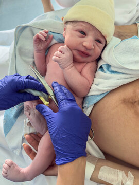 Newborn baby getting umbilical cord clamped after birth