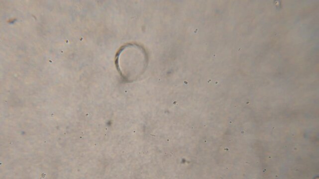 Bacteria Parasites and Worms in drinking Water under Microscope. nematode Worm under Microscope, Parasites Among Roundworms: Roundworms, Pinworms, Trichinella. Environmental Pollution.