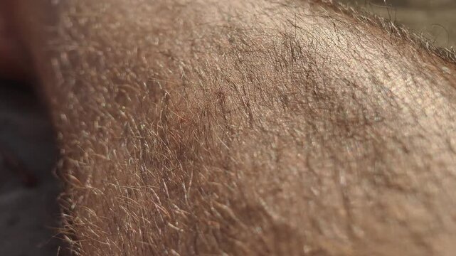 Hairy human skin is captured in an extreme close-up view showing pores and texture details under bright sunlight. Concept of dermatology, body care, and natural skin textures.