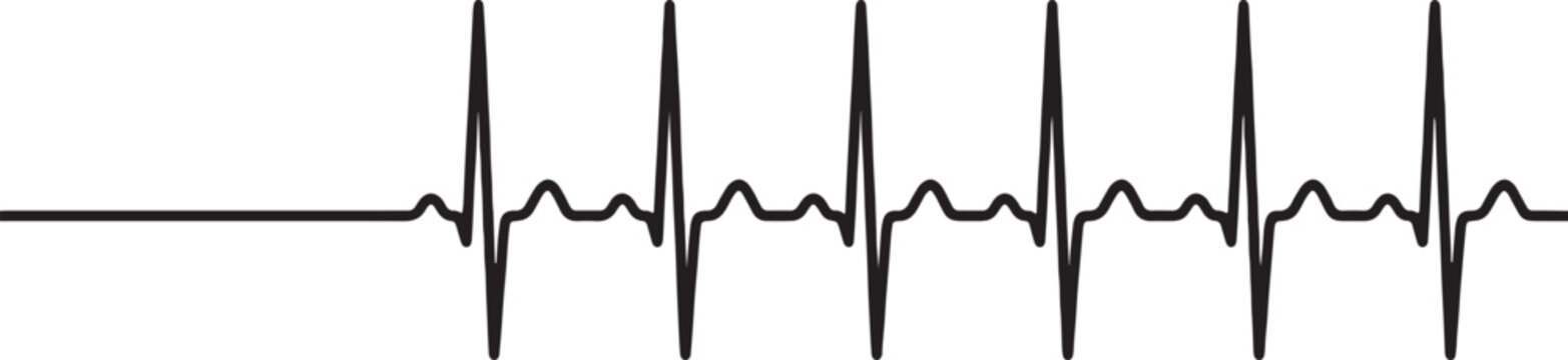 Heartbeat line on transparent background, showing normal heart rhythm for medical and health concepts.