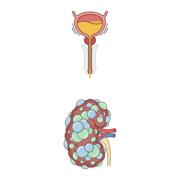 Medical Illustration of Human Urinary System Showing Bladder Function and Polycystic Kidney Disease Anatomy