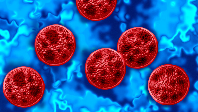 Cyclosporiasis outbreak as a foodborne parasitic illness caused by Cyclospora cayetanensis as an outbreak with contaminated food or water resulting in explosive diarrhea and digestive illness.