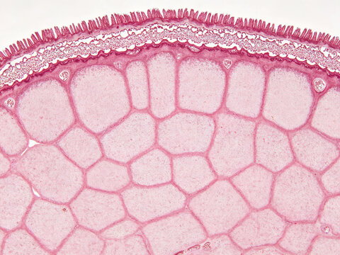 Original H&E-stained photomicrograph of human renal proximal convoluted tubules, showing the characteristic luminal brush border, cuboidal epithelium, and renal cortical structure.