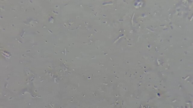 Bacteria growing on spoiled rice close up, contaminated food background