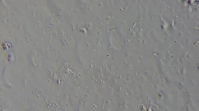 Bacteria growing on spoiled rice close up, contaminated food background
