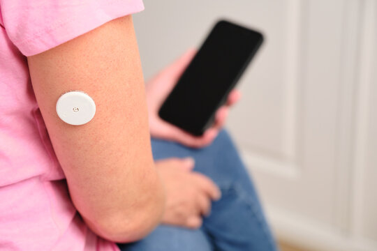 Continuous glucose monitor sensor on arm with smartphone for diabetes management