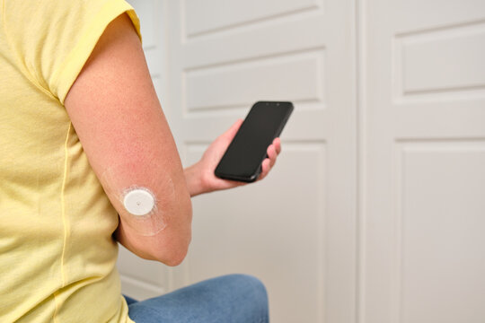 Person using smartphone with continuous glucose monitor for diabetes management
