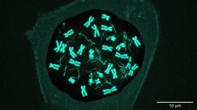 Chromosome structure during cell division, fluorescent microscope micrograph demonstrating condensed dna material inside eukaryotic organism nucleus, genetic replication process.