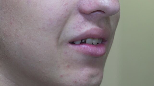 Dental post in tooth canal close up, Dentist restoring severely decayed tooth using a dental post structure