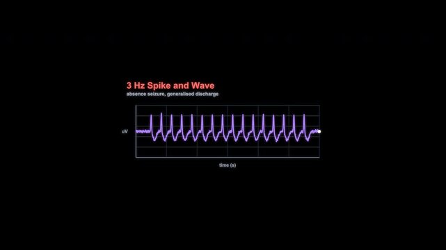 3 Hz Spike and Wave EEG Brain Wave Animation Labeled Alpha Channel 4K