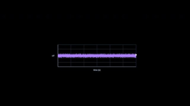 Gamma Waves EEG Brain Wave Animation Clean No Text Alpha Channel 4K