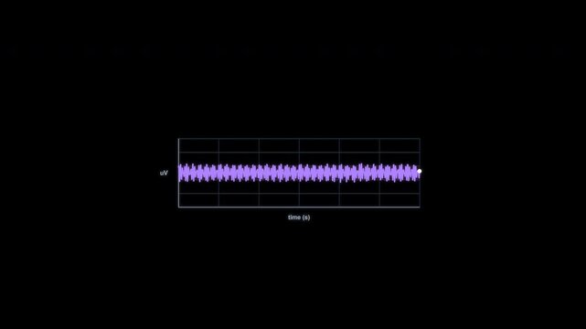 Beta Waves EEG Brain Wave Animation Clean No Text Alpha Channel 4K
