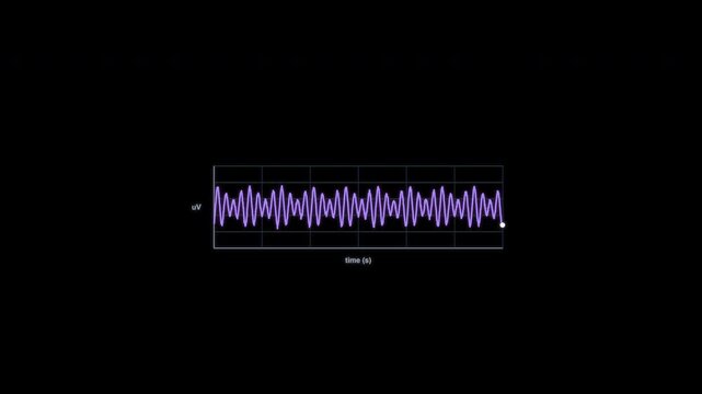 Theta Waves EEG Brain Wave Animation Clean No Text Alpha Channel 4K